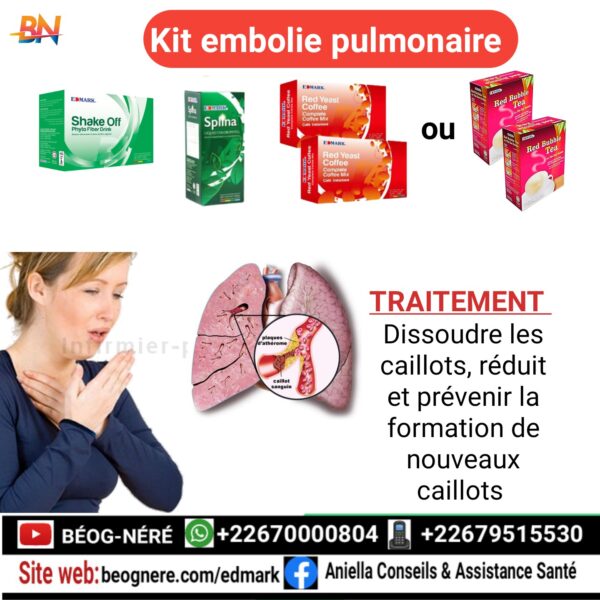 Edmark kit embolie pulmonaire