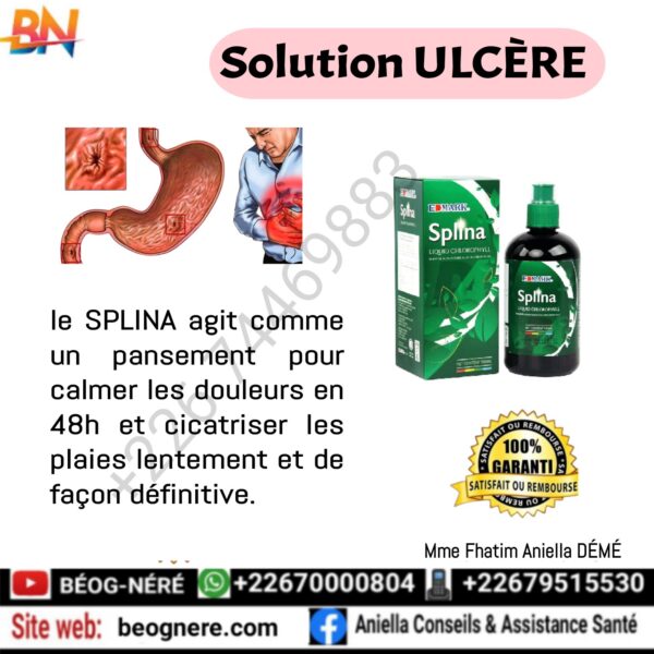 edmark kit solution ulcère