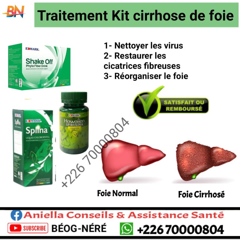 cirrhose de foie traitement edmark