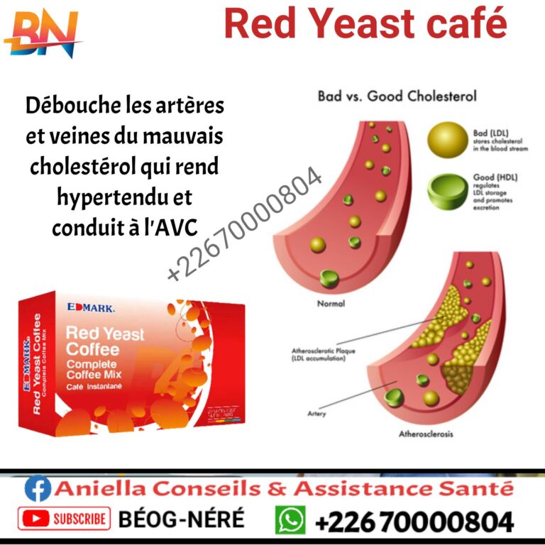 Red Yeast Café Edmark